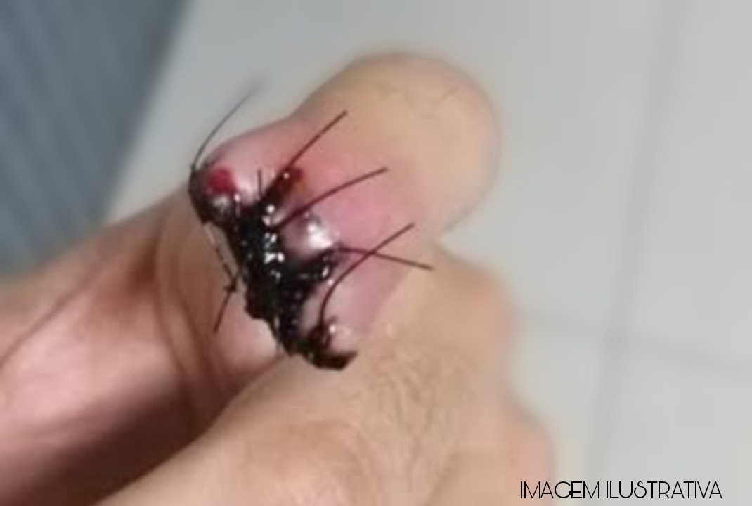 foto de Homem perdeu parte do dedo depois da sua companheira dar uma mordida nele, em Sarandi