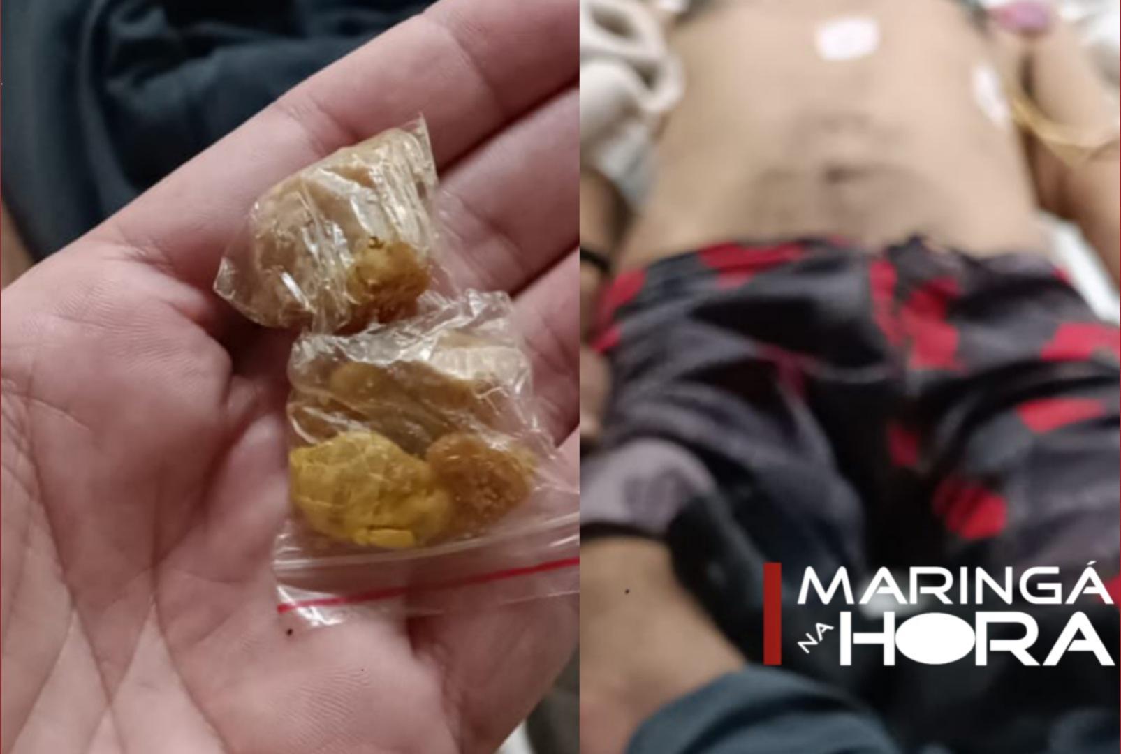 foto de Homem engole droga e no hospital é encontrado entorpecente dentro do seu ânus, em Maringá