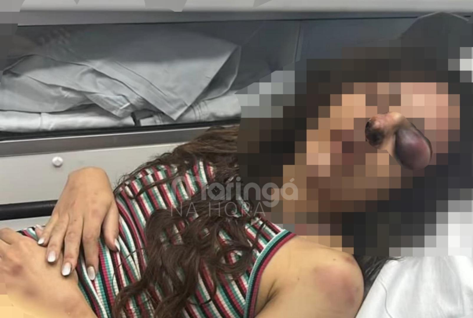 foto de Médica de Maringá brutalmente agredida dentro de apartamento conta momentos de terror que viveu