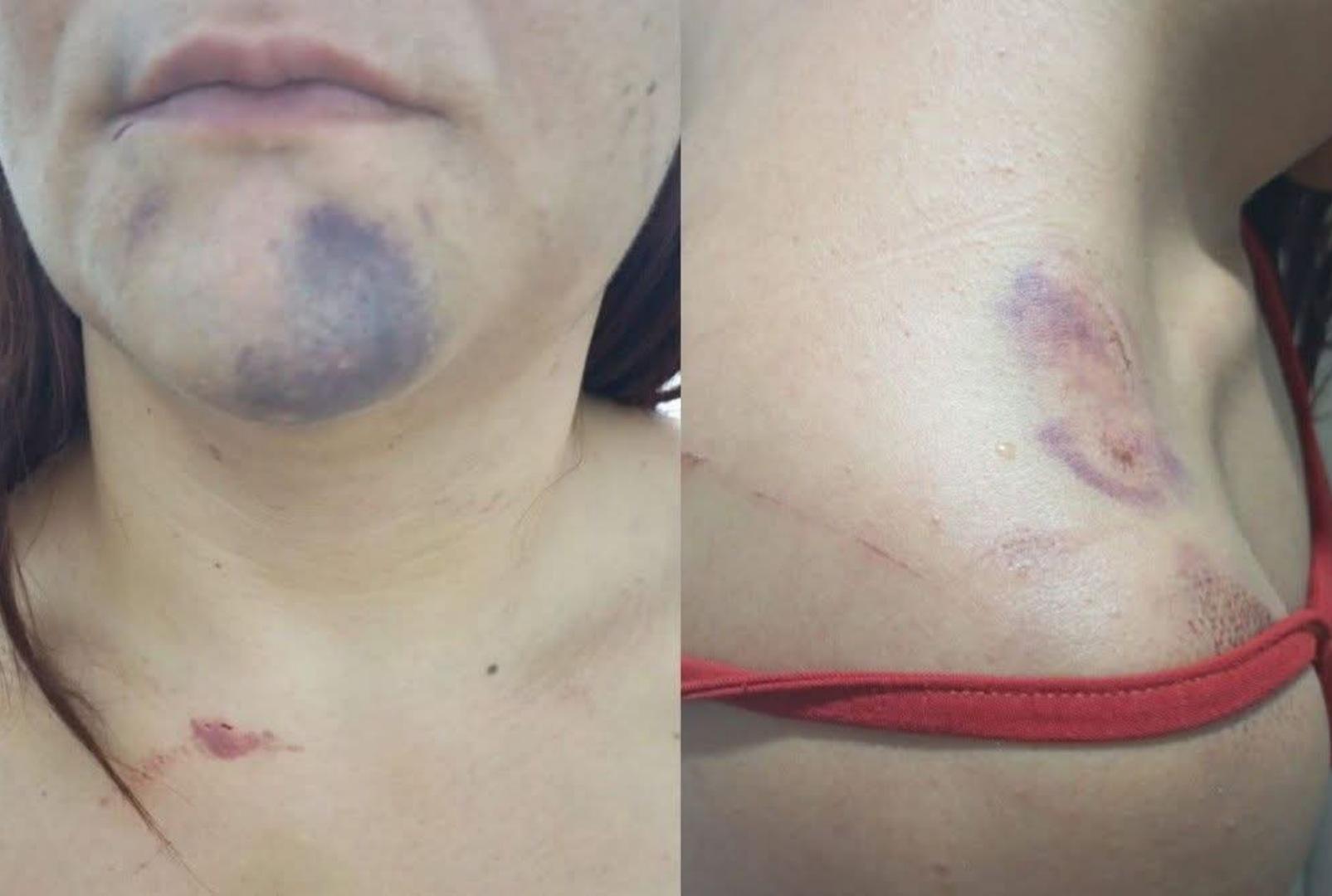 foto de Mulher que passou a madrugada sendo torturada pelo namorado no PR relata momentos de terror: Me enforcava até sumir todo o meu ar