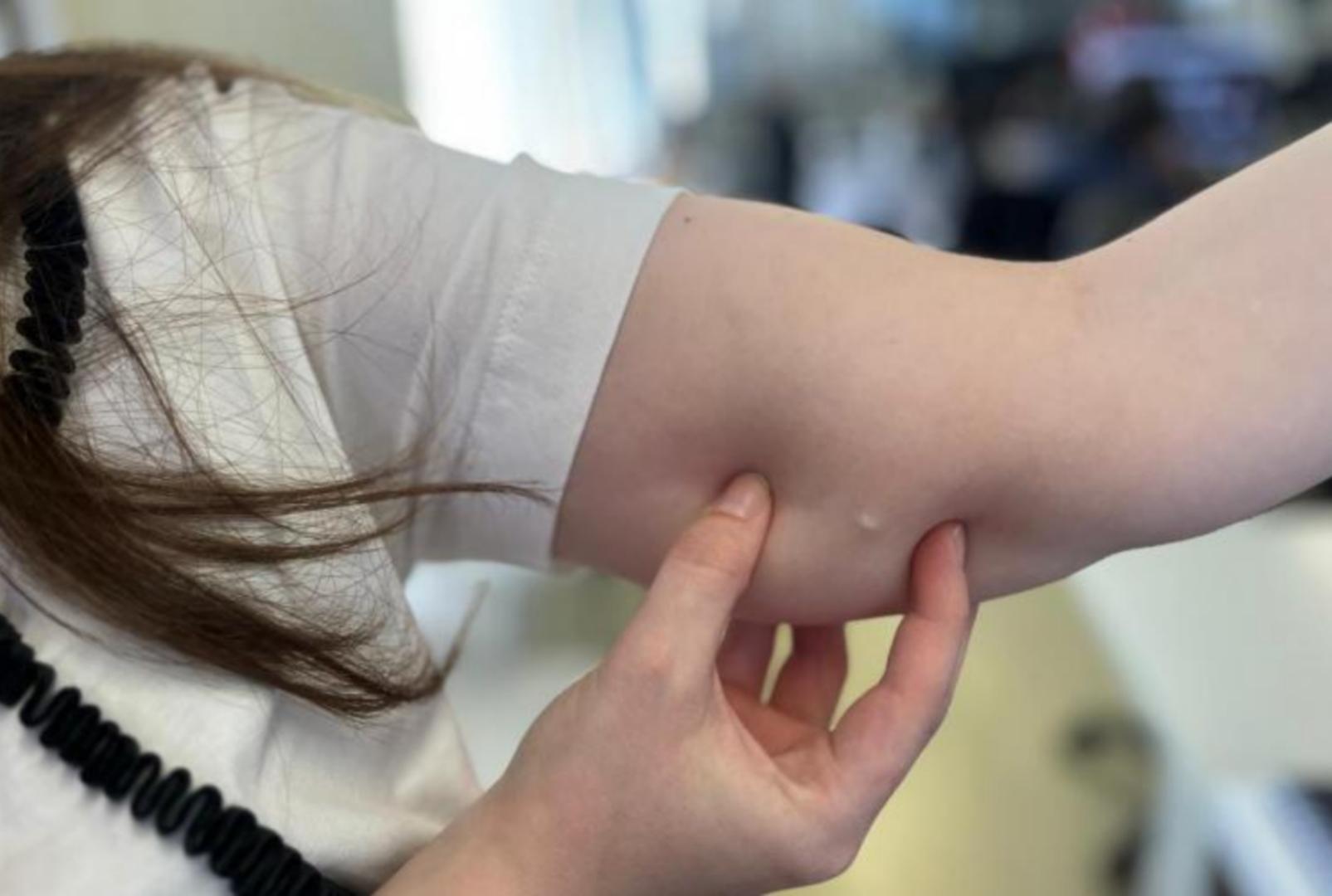 foto de Aumento na procura por implantes contraceptivos no SUS no Paraná