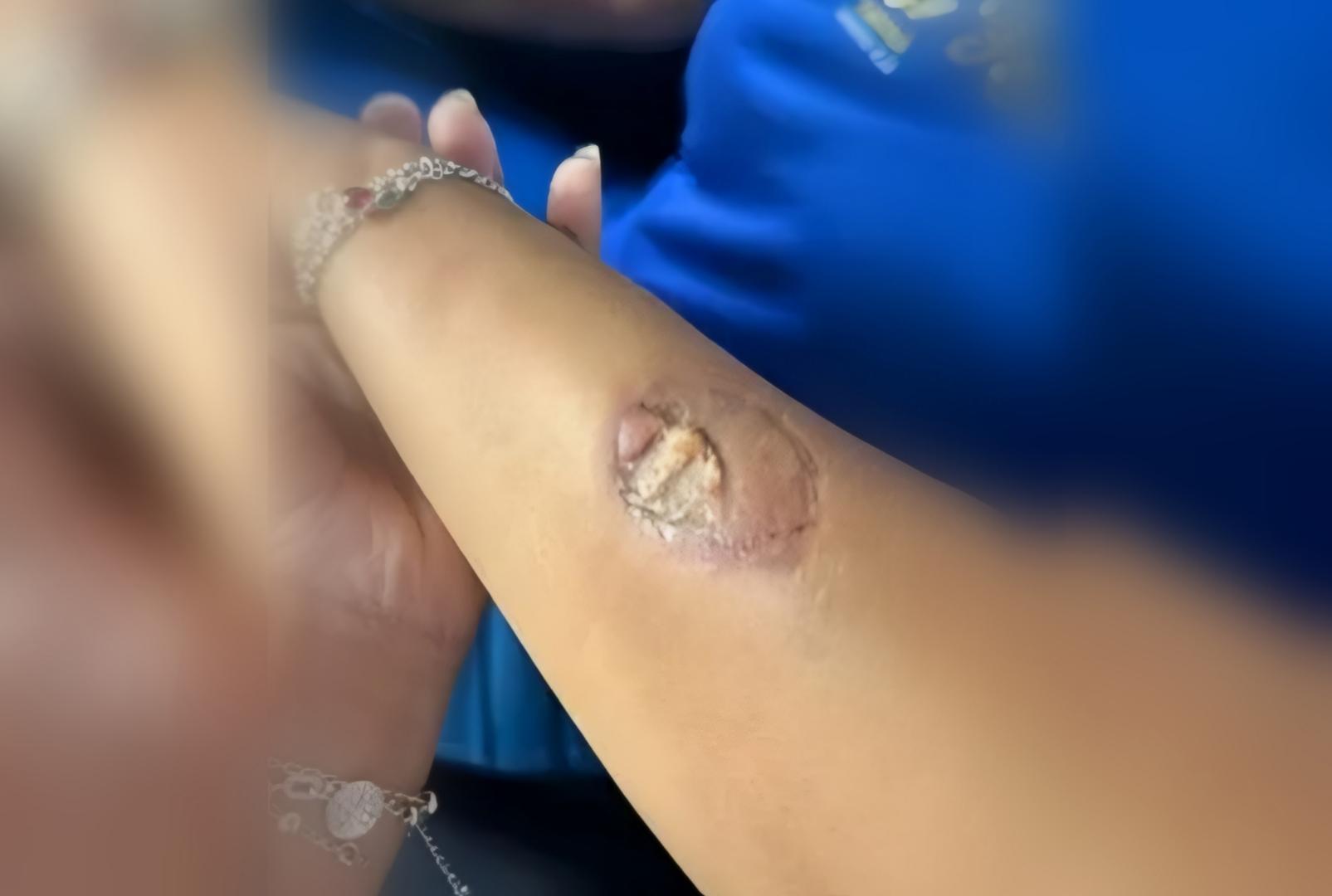 foto de Mãe de estudante agride funcionárias com capacete e morde vice-diretora em escola do PR