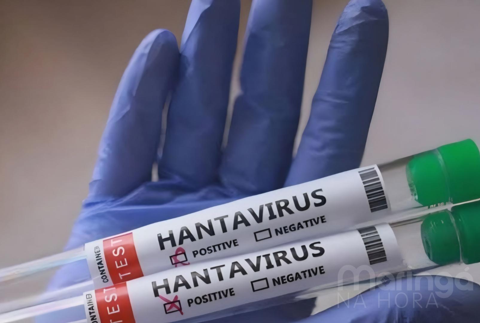 foto de Paraná confirma dois casos de hantavírus no estado; 11 são investigados