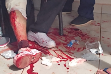 foto de Homem é ferido com golpes de facão após suposta demissão