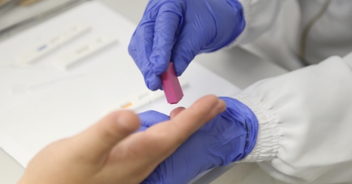 Saúde promove ação Pré-Carnaval com testagem rápida para HIV, sífilis e hepatites nesta sexta, 28