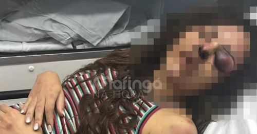 Médica de Maringá brutalmente agredida dentro de apartamento conta momentos de terror que viveu