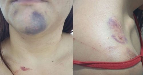 Mulher que passou a madrugada sendo torturada pelo namorado no PR relata momentos de terror: Me enforcava até sumir todo o meu ar