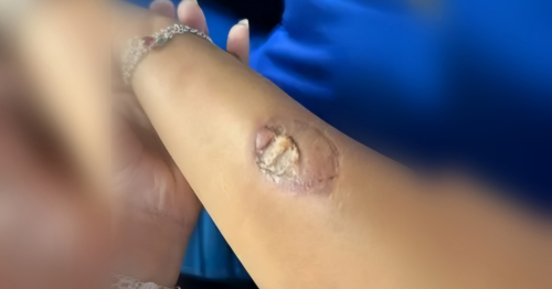 Mãe de estudante agride funcionárias com capacete e morde vice-diretora em escola do PR