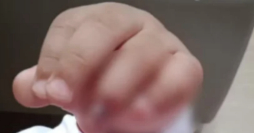 Família será indenizada em R$ 10 mil após criança se ferir em brinquedo público